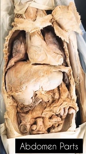 Abdominal organs (plastic anatomy)￼Sam Webster