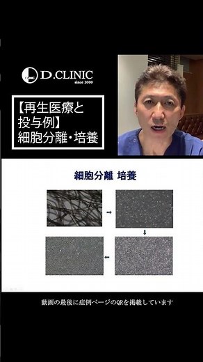 医療現場からの情報発信◆◆「再生医療 治療成果と投与例」（4）細胞分離培養 #再生医療 #幹細胞