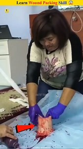 How Trauma Kit Works #medicaldevices #innovation #firstaid #medical #reelsviralシ trendingdevices | FACTS TIME