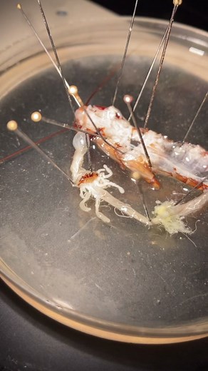 Cockroach Dissection: Understanding Insect Anatomy