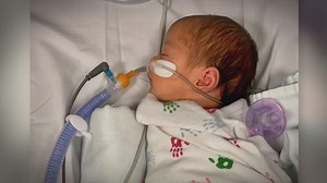 New RSV treatment shows promise in protecting babies from dangerous infections