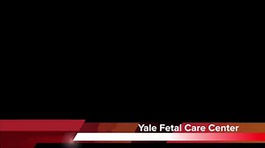 fetoscopy video