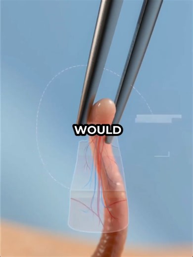 Risks of Using Tweezers on Skin Tags Explained