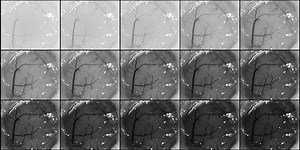 Multi-Exposure Speckle Imaging | Functional Optical Imaging Laboratory