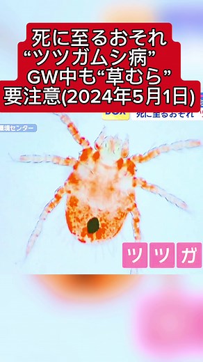 #最速のニュース #死に至るおそれ“ツツガムシ病”(2024年5月1日)#typ