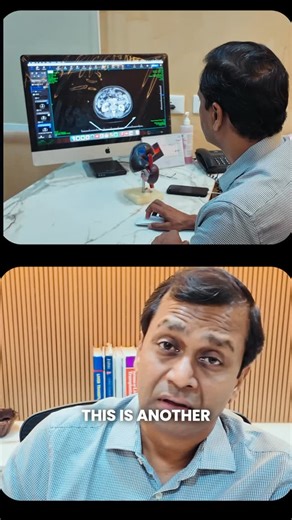 Dr. Vivek Shanmugam on Instagram: "Another liver cancer patient today. Most liver cancers don’t start suddenly; they build silently. Smoking. Alcohol. Fatty liver. Hepatitis B. 80% of liver cancers are preventable, but symptoms appear very late. Early scans can save lives. Delay can cost everything. #DrVivek #LiverCancerAwareness #PreventiveHealthcare #EarlyDetectionSavesLives #HealthAwareness DoctorReels MedicalReels PublicHealthIndia LiverHealth CancerPrevention StayHealthy"