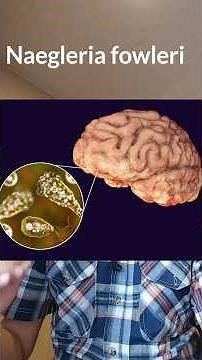 Human Brain Eating Microorganism : Nagleria Fowleri