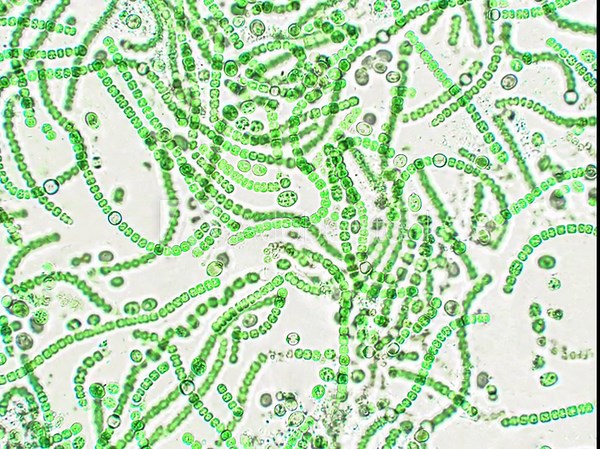 Nostoc sp. algae under microscopic view, cyanobacteria, blue-green algae