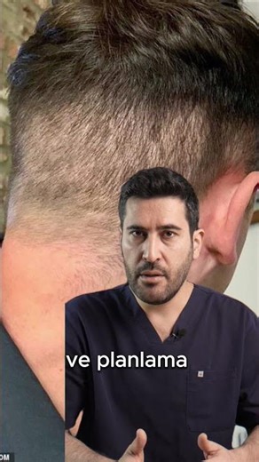 Saç Ekimi Sonrası İz Kalır mı? | Hair Transplant Scarring Explained