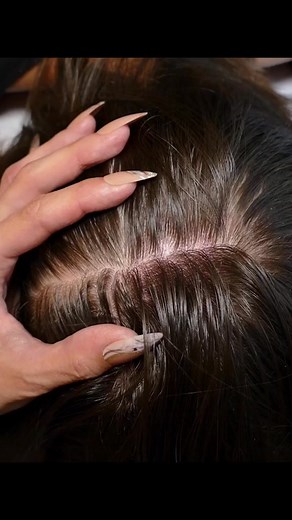 ASMR Intense Scalp SCRATCHING and NITPICKING with Nails (Real Person) #asmr #asmrsounds #asmrvideo #asmrtiktoks #scalp #scalpcheck #asmrsensory #asmrroleplay #asmrmedical #asmrdoctorroleplay | Oliver Anderson