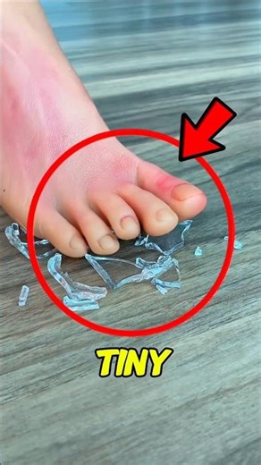 Got Glass in Your Foot? Don't Pull It Out Yet! Do This First‼️