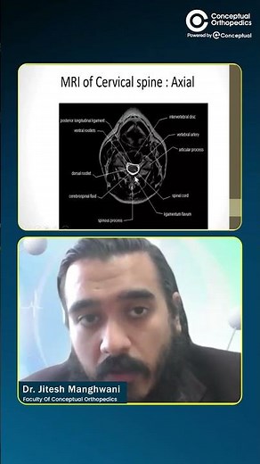 How to Read Axial Cervical Spine MRI | Every Resident Should Know |Dr. Jitesh Manghwani