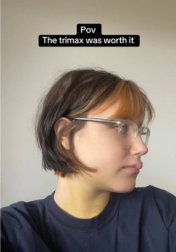 Experiencing the Trimax Surgery: My Journey to Symmetry