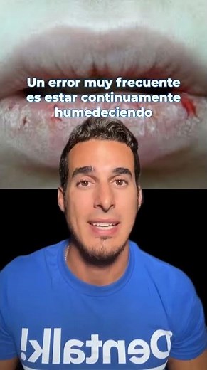 How to Heal Cracked, Dry, Burnt, or Chapped Lips - Home Remedies