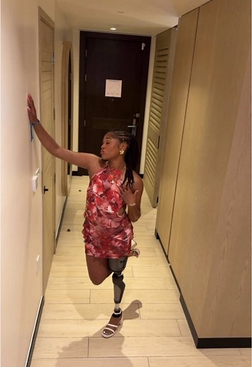 Get Ready with Me: Embracing Amputee Life and Fashion