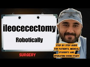 What to Expect for ileocecectomy Robotically Surgery 😳(Step by step guide) must 👀