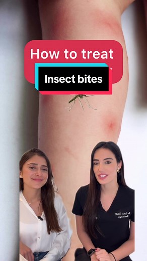 ‏How to treat insect bites. #insectbite #insects #bites #drsamarkhalil