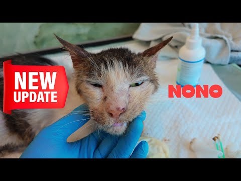 Update on Nono & Nurse Roy 🙏🏻.