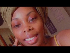 - Dentures - 24 Hours after 17 extractions & immediate Dentures - Full set of dentures -How to heal