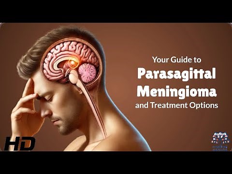 What Is Parasagittal Meningioma? A Doctor’s Insight!
