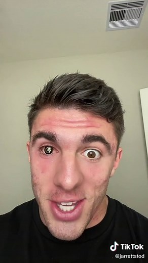 Bionic Eye Unboxing and Review!