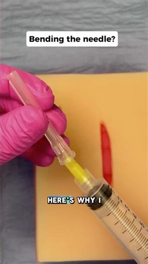 Why I Bend My Needle for Local Anesthesia 😁 #medicaleducation #clinicalskills #shorts