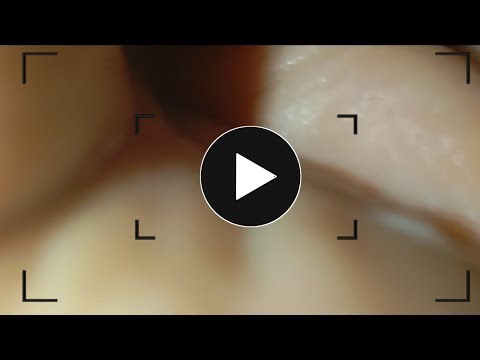 LYRA VLOG | Fingertip Soft Phase ASMR for Subtle Mind Shift – 20 March 2026