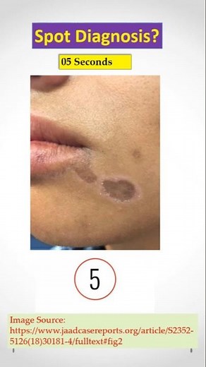 Dermatology Spot Diagnosis Quiz #49. Doctors, check your Clinical Skill