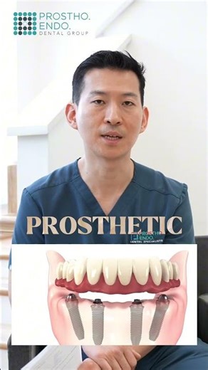 What Is All-on-X? Permanent Teeth With 46 Implants Explained Prostho Endo Dental Group #shorts