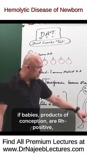 Hemolytic Disease of Newborn #drnajeeb #drnajeeb #drnajeeblectures #shorts