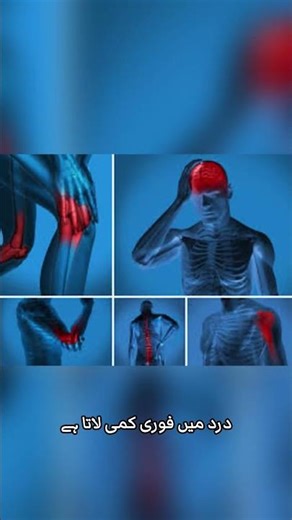 Why Should You Get Hijama? | Islamic & Medical Benefits Explained