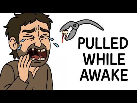 Why It Sucked To Practice Dentistry Before Anesthesia