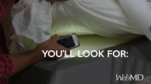 33K views · 185 reactions | Bedbugs can live for 10 months, and can go weeks without feeding.  https://wb.md/2R5gA0v | WebMD | Facebook