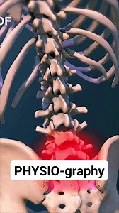 Sacralization of L5 #fblifestyle #physicaltherapy #physiotherapy #physiotherapist #physicaltherapist #orthopedics | PHYSIO-graphy