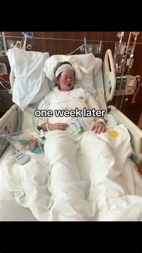 Stevens-Johnson Syndrome Progression Timeline