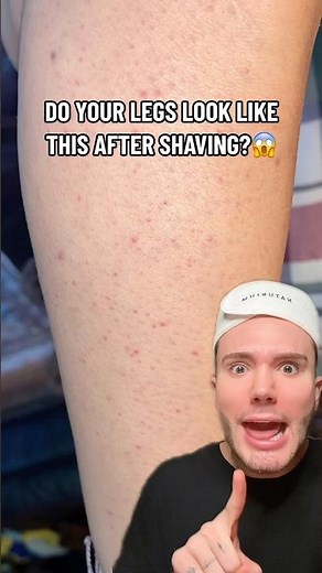 HOW TO GET RID OF BUMPS ON YOUR LEGS!😱 (follow for more!💗) #beautytips #beauty #skincare #skin