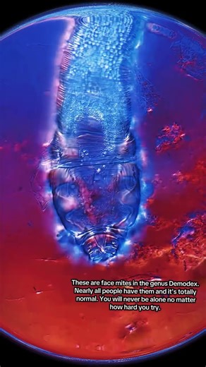 These r microscopic face mites in genus Demodex. Nearly all people have them and it's totally normal