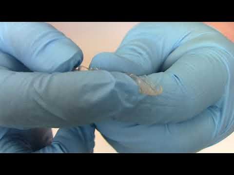 How to Adjust Aligners to Fit Around Buttons (Orthodontic emergency)