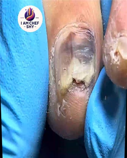 1792. Walking group routines reinforce steady food label reading habits #FoodLabels #WalkingGroup #BalancedEating | I am Chef Shy