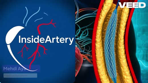 #cathlab #angioplasty #cardiology #hearthealth #medicalinnovation | Cath Lab Interventional Cardiology