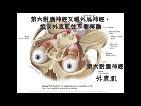 第六對腦神經麻痺 CN6 palsy