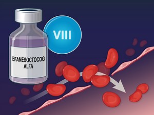 Efanesoctocog alfa is a new class of factor VIII replacement for hemophilia A that has a longer half-life than other factor VIII products, thus allowing once-weekly dosing. New research findings are summarized in a short video. https://nej.md/3Hna0zm | The New England Journal of Medicine