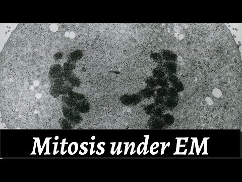 Mitosis Under Electron Microscope
