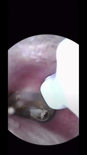 so many scabs and not not enough time to pick them #short ￼