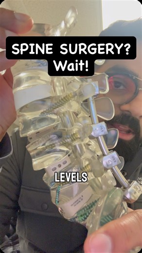 Endoscopic spine surgery can sometimes help you avoid screws and rods. Not everyone needs a fusion. Not everyone needs hardware. Sometimes the problem is just one irritated nerve. One disc fragment. One small area causing big pain. If you can fix the problem without stabilizing the whole spine …why not talk about that first? Endoscopic spine surgery uses a tiny camera and a very small working channel to go directly to the source of pain while preserving motion and minimizing collateral damage. T