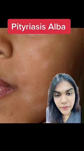elleskinclinic on TikTok