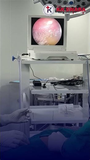 Breathe Better Today: How Thoracoscopy Can Save Your Lungs 🫁✨