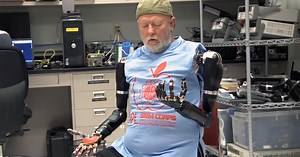 Double amputee controls two prosthetic arms at once, using his mind