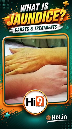 What is Jaundice? Causes and Treatments - Dr. Kiran K Peddi , Medical Gastroenterologist