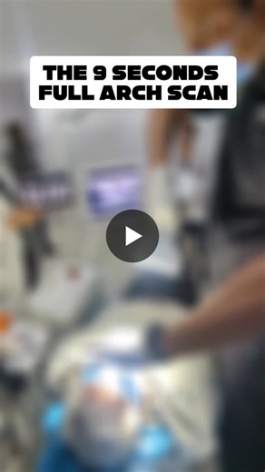9 Seconds. A full-arch implant scan using extraoral photogrammetry with the Micron Mapper — capturing implant positions with exceptional accuracy and enabling true passive fit of the… | Dr. Nirmal Kurian